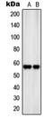 Solute Carrier Family 22 Member 17 antibody, LS-C353437, Lifespan Biosciences, Western Blot image 
