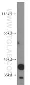 Calcium Activated Nucleotidase 1 antibody, 12164-1-AP, Proteintech Group, Western Blot image 