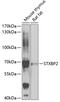 Syntaxin-binding protein 2 antibody, GTX33529, GeneTex, Western Blot image 