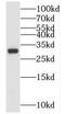 Nitrilase Family Member 2 antibody, FNab05742, FineTest, Western Blot image 