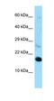 Ribosomal Protein L22 antibody, orb331235, Biorbyt, Western Blot image 