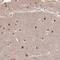 Suppression of tumorigenicity 18 protein antibody, HPA044919, Atlas Antibodies, Immunohistochemistry frozen image 