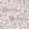 Acetyl-CoA Acetyltransferase 1 antibody, A5335, ABclonal Technology, Immunohistochemistry paraffin image 
