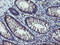 Copper Metabolism Domain Containing 1 antibody, LS-C337778, Lifespan Biosciences, Immunohistochemistry paraffin image 