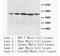 Malonyl-CoA-acyl carrier protein transacylase, mitochondrial antibody, AP23412PU-N, Origene, Western Blot image 