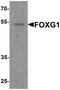 Forkhead Box G1 antibody, NBP2-81942, Novus Biologicals, Western Blot image 