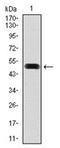 Fibronectin 1 antibody, AM06755PU-N, Origene, Western Blot image 