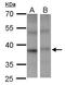 Proline-serine-threonine phosphatase-interacting protein 2 antibody, PA5-28913, Invitrogen Antibodies, Western Blot image 