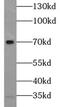 Selenoprotein N antibody, FNab07716, FineTest, Western Blot image 
