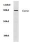 Ezrin antibody, AP21103PU-N, Origene, Western Blot image 