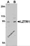Leucine Zipper Like Transcription Regulator 1 antibody, 5621, ProSci, Western Blot image 