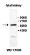 PDZ Domain Containing 3 antibody, orb77911, Biorbyt, Western Blot image 