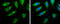 Pyruvate Dehydrogenase E1 Alpha 1 Subunit antibody, GTX104015, GeneTex, Immunofluorescence image 