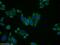 Alpha-N-acetylgalactosaminidase antibody, 15096-1-AP, Proteintech Group, Immunofluorescence image 