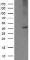 Carboxypeptidase A2 antibody, NBP2-46344, Novus Biologicals, Western Blot image 
