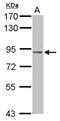 Podocan antibody, NBP2-19881, Novus Biologicals, Western Blot image 