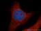 Ribosomal Protein L14 antibody, 14991-1-AP, Proteintech Group, Immunofluorescence image 