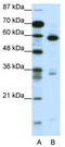 mBD-1 antibody, TA345662, Origene, Western Blot image 