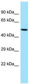 G-Patch Domain Containing 4 antibody, TA343246, Origene, Western Blot image 