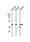 Unr antibody, M09252, Boster Biological Technology, Western Blot image 