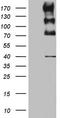 ALK Receptor Tyrosine Kinase antibody, TA801074, Origene, Western Blot image 