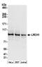 Leucine Rich Repeats And Calponin Homology Domain Containing 1 antibody, A304-910A, Bethyl Labs, Western Blot image 