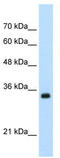 Apolipoprotein B MRNA Editing Enzyme Catalytic Subunit 3D antibody, TA344007, Origene, Western Blot image 