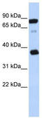 B Cell Receptor Associated Protein 29 antibody, TA336145, Origene, Western Blot image 