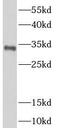 N-Acetyltransferase 1 antibody, FNab09978, FineTest, Western Blot image 