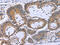 Microtubule Associated Protein RP/EB Family Member 3 antibody, CSB-PA920250, Cusabio, Immunohistochemistry frozen image 