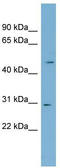 NADH:Ubiquinone Oxidoreductase Core Subunit S3 antibody, TA342216, Origene, Western Blot image 