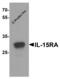 Interleukin-15 receptor subunit alpha antibody, 7233, ProSci, Western Blot image 