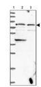 Erythrocyte Membrane Protein Band 4.2 antibody, NBP1-82762, Novus Biologicals, Western Blot image 