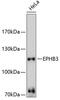 Ephrin type-B receptor 3 antibody, 13-506, ProSci, Western Blot image 