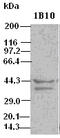 ICAD antibody, M03671, Boster Biological Technology, Western Blot image 