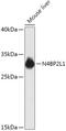 NEDD4 Binding Protein 2 Like 1 antibody, 18-107, ProSci, Western Blot image 