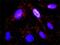Src substrate protein p85 antibody, H00002017-M01, Novus Biologicals, Proximity Ligation Assay image 