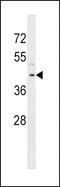 Ribonucleotide Reductase Regulatory TP53 Inducible Subunit M2B antibody, LS-C162769, Lifespan Biosciences, Western Blot image 