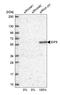 Eukaryotic translation initiation factor 5 antibody, NBP1-86184, Novus Biologicals, Western Blot image 