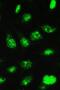 Ubiquitin Conjugating Enzyme E2 I antibody, A02295, Boster Biological Technology, Immunofluorescence image 