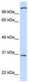 Toll Like Receptor 2 antibody, TA329156, Origene, Western Blot image 