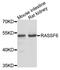 Ras association domain-containing protein 6 antibody, STJ27165, St John
