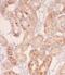 Peroxisomal membrane protein 11C antibody, FNab06326, FineTest, Immunohistochemistry paraffin image 
