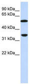 Complement Component 4B (Chido Blood Group), Copy 2 antibody, TA346240, Origene, Western Blot image 