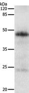 Ta antibody, TA323178, Origene, Western Blot image 
