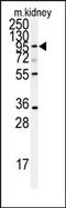 ADAM Metallopeptidase Domain 9 antibody, AP14084PU-N, Origene, Western Blot image 