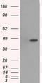 Mitogen-activated protein kinase 12 antibody, NBP1-47852, Novus Biologicals, Western Blot image 