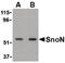 SKI Like Proto-Oncogene antibody, LS-B553, Lifespan Biosciences, Western Blot image 