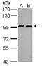 Ankyrin repeat and zinc finger domain-containing protein 1 antibody, PA5-30665, Invitrogen Antibodies, Western Blot image 