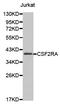 Colony Stimulating Factor 2 Receptor Alpha Subunit antibody, LS-C332392, Lifespan Biosciences, Western Blot image 